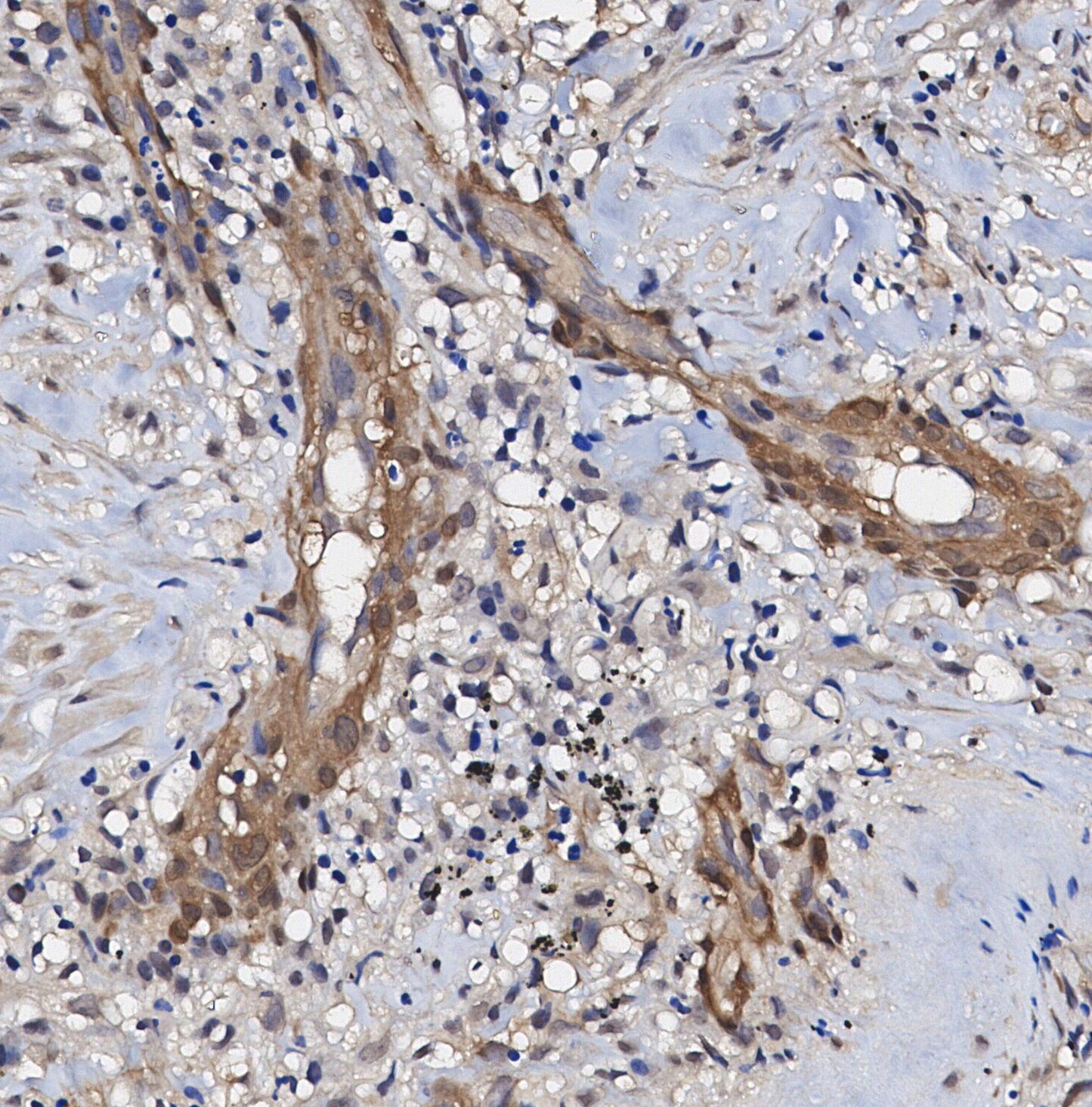 NDUFS3 Antibody