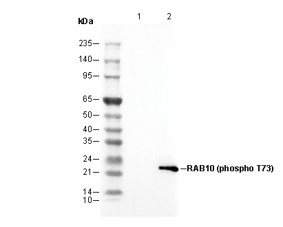 Phospho-RAB10 (Thr73) Antibody