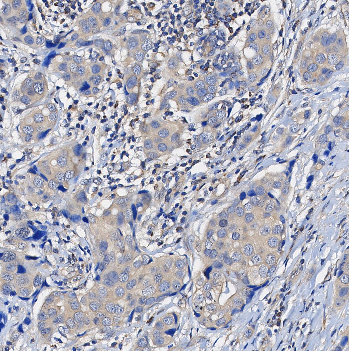 ERK2 Antibody