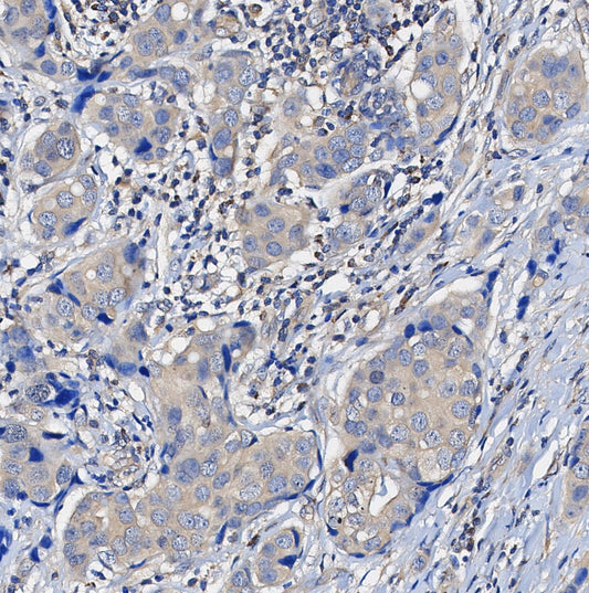 ERK2 Antibody