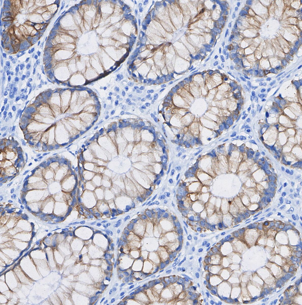 Dysferlin Antibody