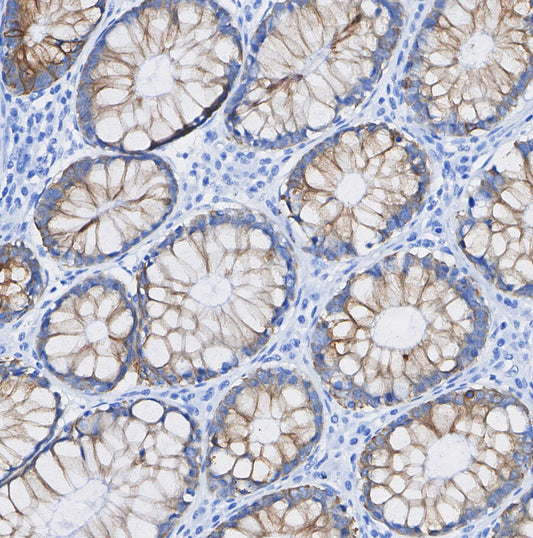 Dysferlin Antibody