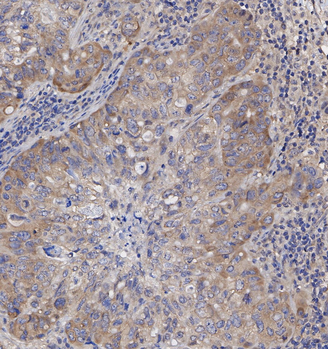 MSI2 Antibody