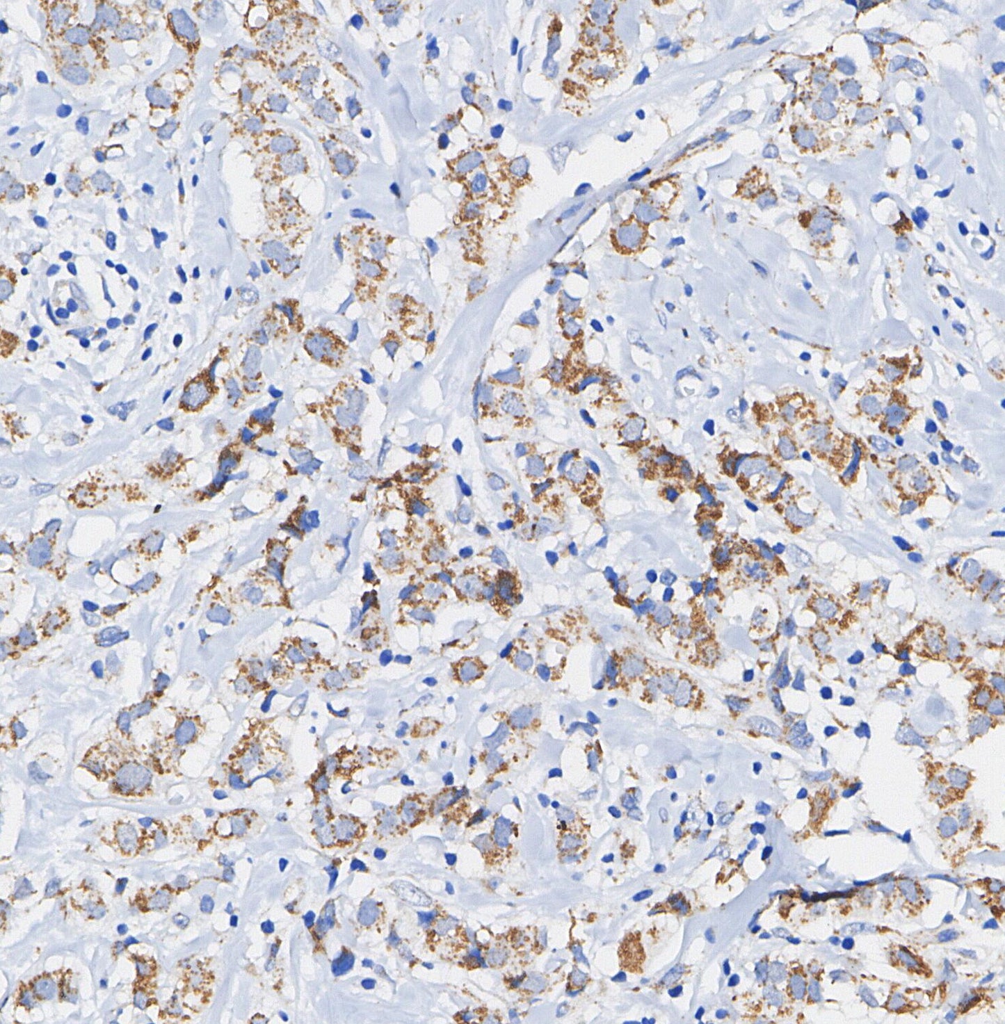 Phospho-PDHA1 (Ser293) Antibody