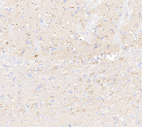 C1q Antibody