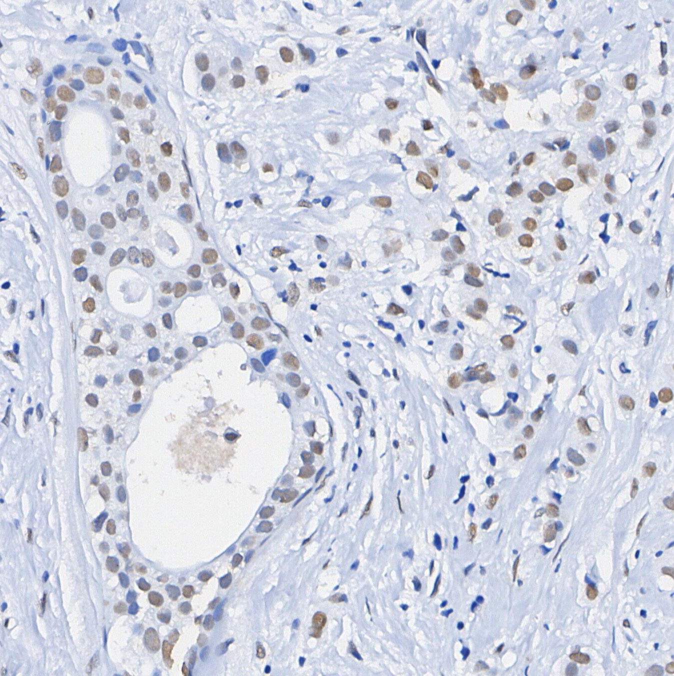 ALKBH5 Antibody