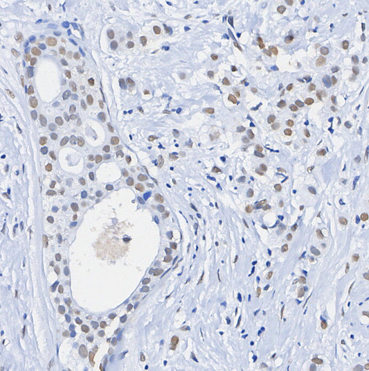 ALKBH5 Antibody