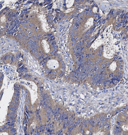 Peroxiredoxin 2/PRP Antibody