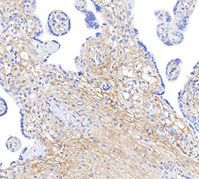 Collagen IV Antibody