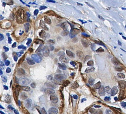 Phospho-eIF4E (Ser209) Antibody