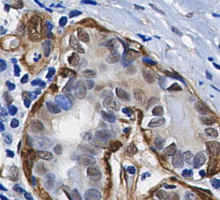 Phospho-eIF4E (Ser209) Antibody