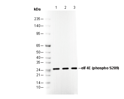Phospho-eIF4E (Ser209) Antibody