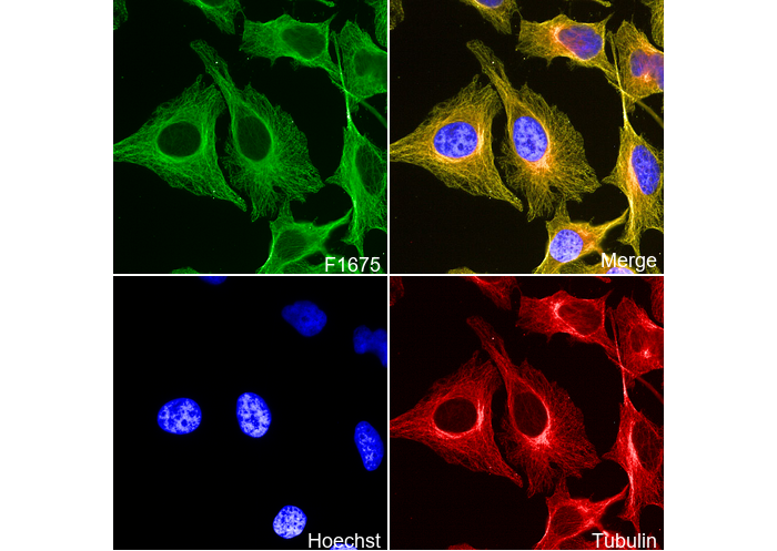 β IV Tubulin Antibody