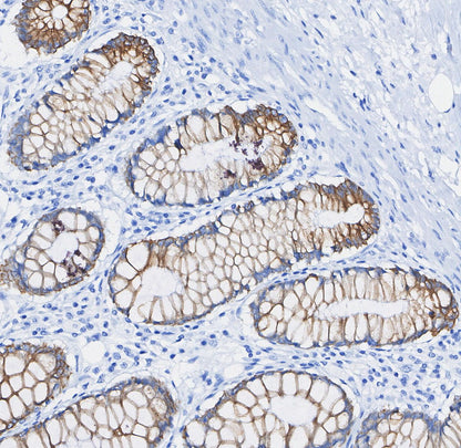 β IV Tubulin Antibody