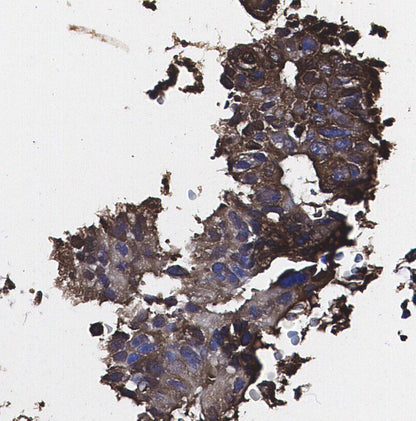 WIPI2 Antibody