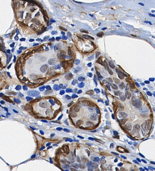 NeuroD1 Antibody