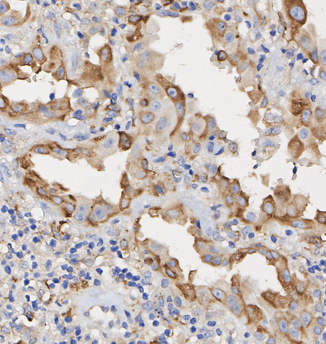 Ezrin Antibody