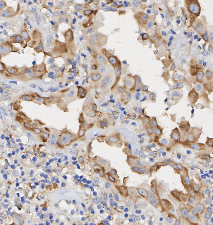 Ezrin Antibody