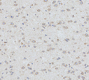 Endothelial Cell Antibody