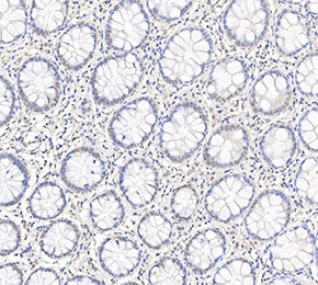 8-Hydroxy-2'-deoxyguanosine Antibody