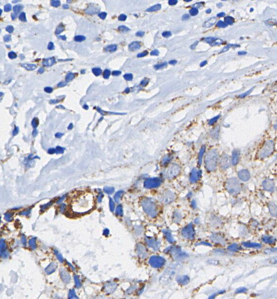 PI3 Kinase p85α Antibody