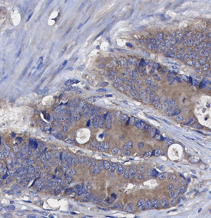 TICAM-1(TRIF) Antibody
