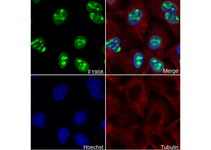 NPM1 Antibody