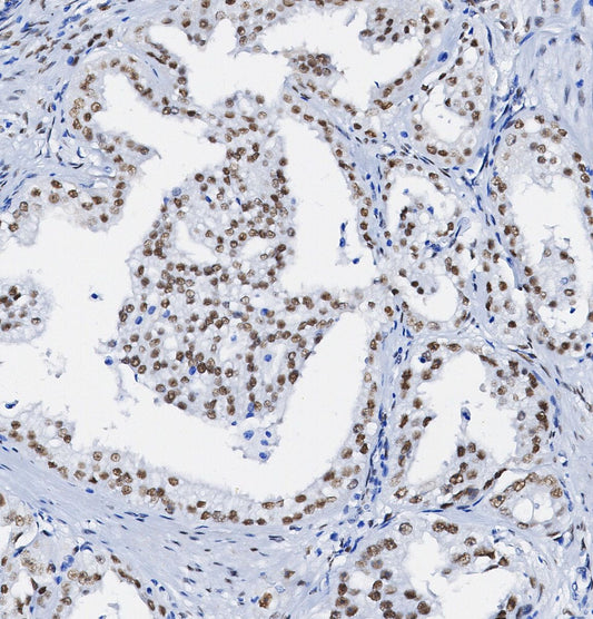 NPM1 Antibody