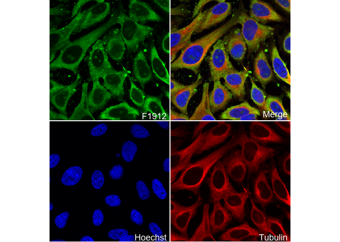 Thrombospondin 1 Antibody