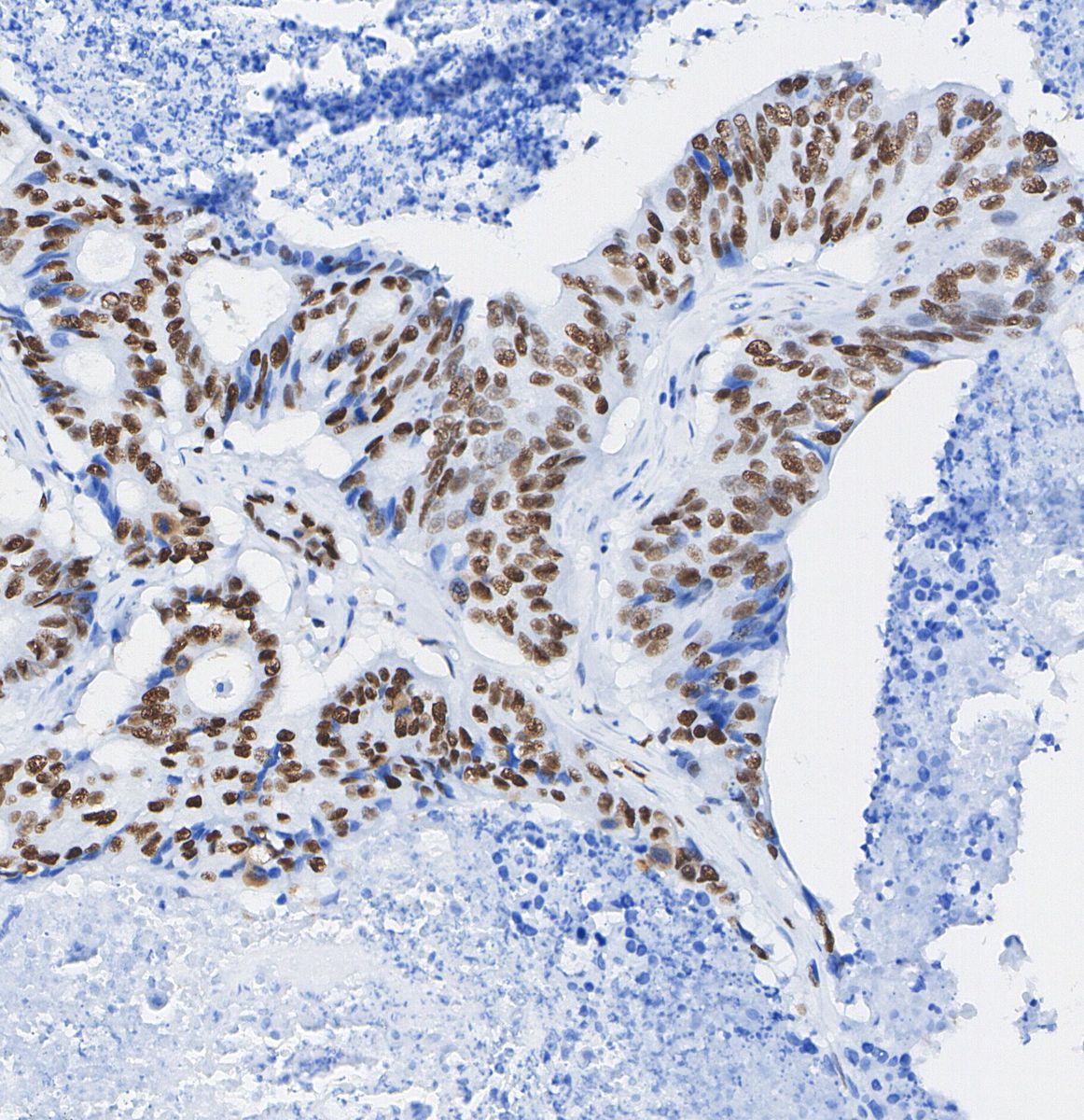 CtBP1 Antibody