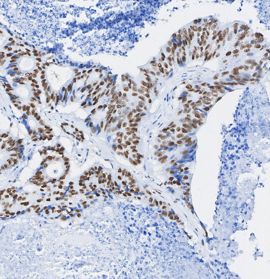 CtBP1 Antibody