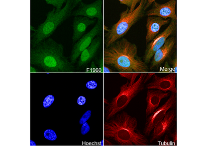 HMGN2 Antibody