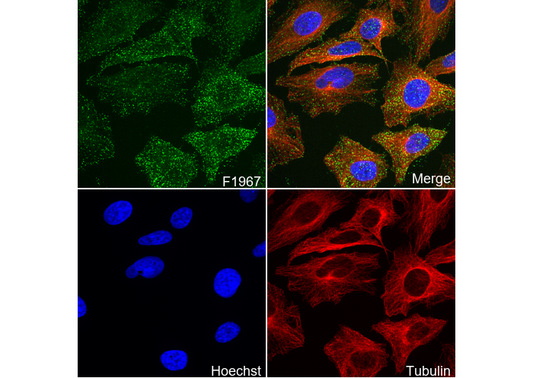 Phospho-AP2M1 (Thr156) Antibody