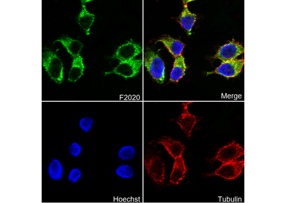 15 Lipoxygenase 1 Antibody