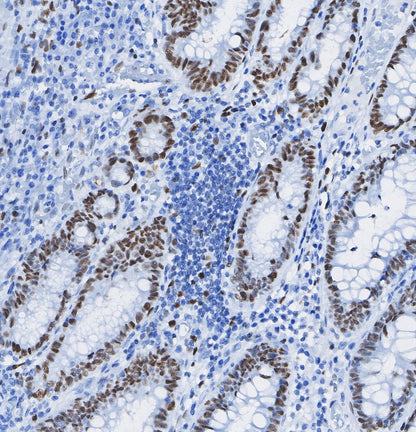 PMS2 Antibody