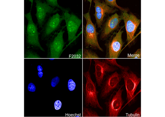 PI 3 Kinase p85 β Antibody