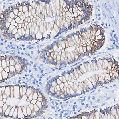 PI 3 Kinase p85 β Antibody