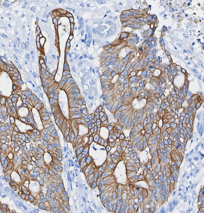 α Actinin 4 Antibody