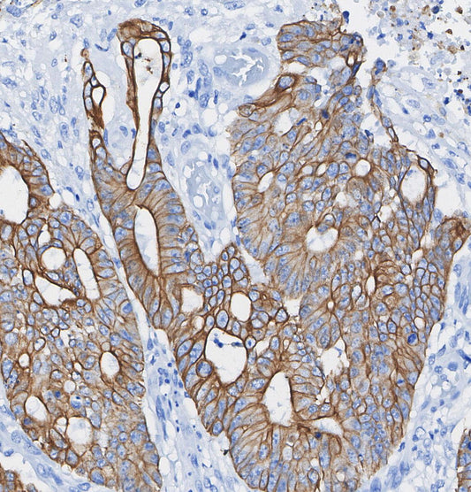 α Actinin 4 Antibody