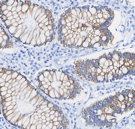 MGEA5/OGA Antibody