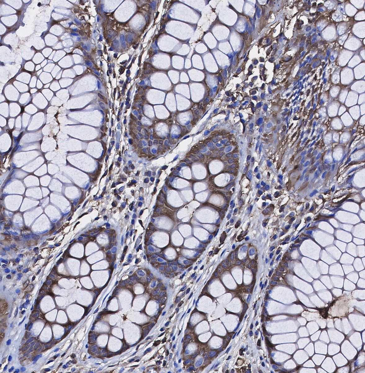 Laminin Receptor Antibody
