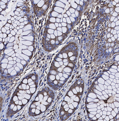 Laminin Receptor Antibody