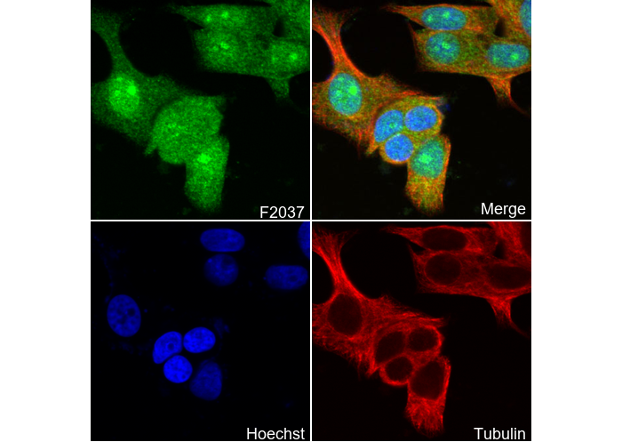 Tartrate Resistant Acid Phosphatase Antibody