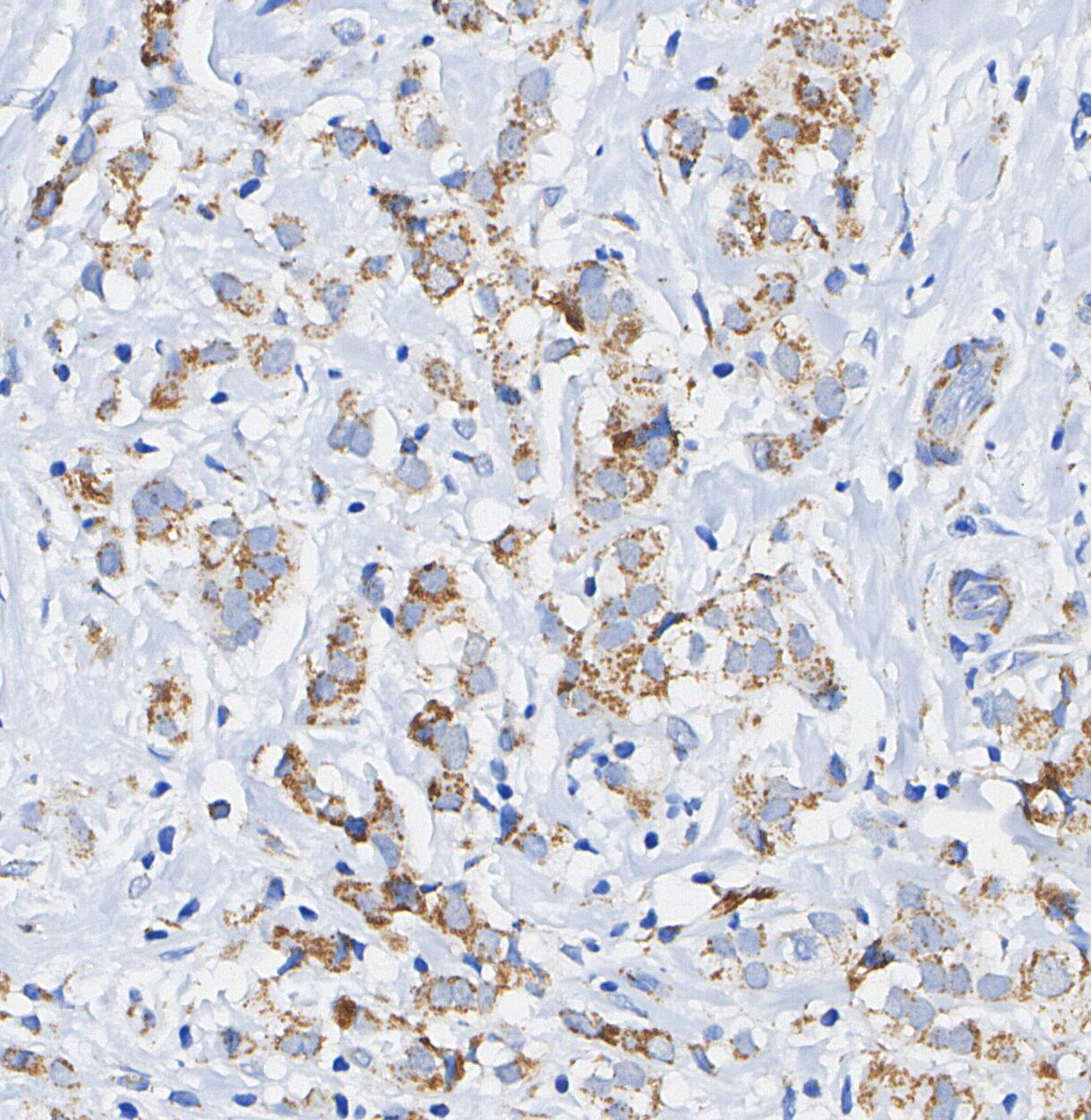 Tartrate Resistant Acid Phosphatase Antibody