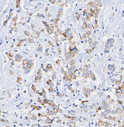 Tartrate Resistant Acid Phosphatase Antibody
