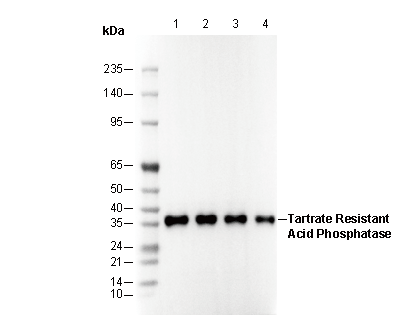 Tartrate Resistant Acid Phosphatase Antibody