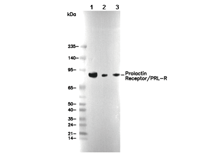 Prolactin Receptor/PRL-R Antibody