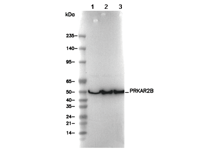 PRKAR2B Antibody