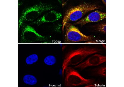 ATP6V0D1/P39 Antibody