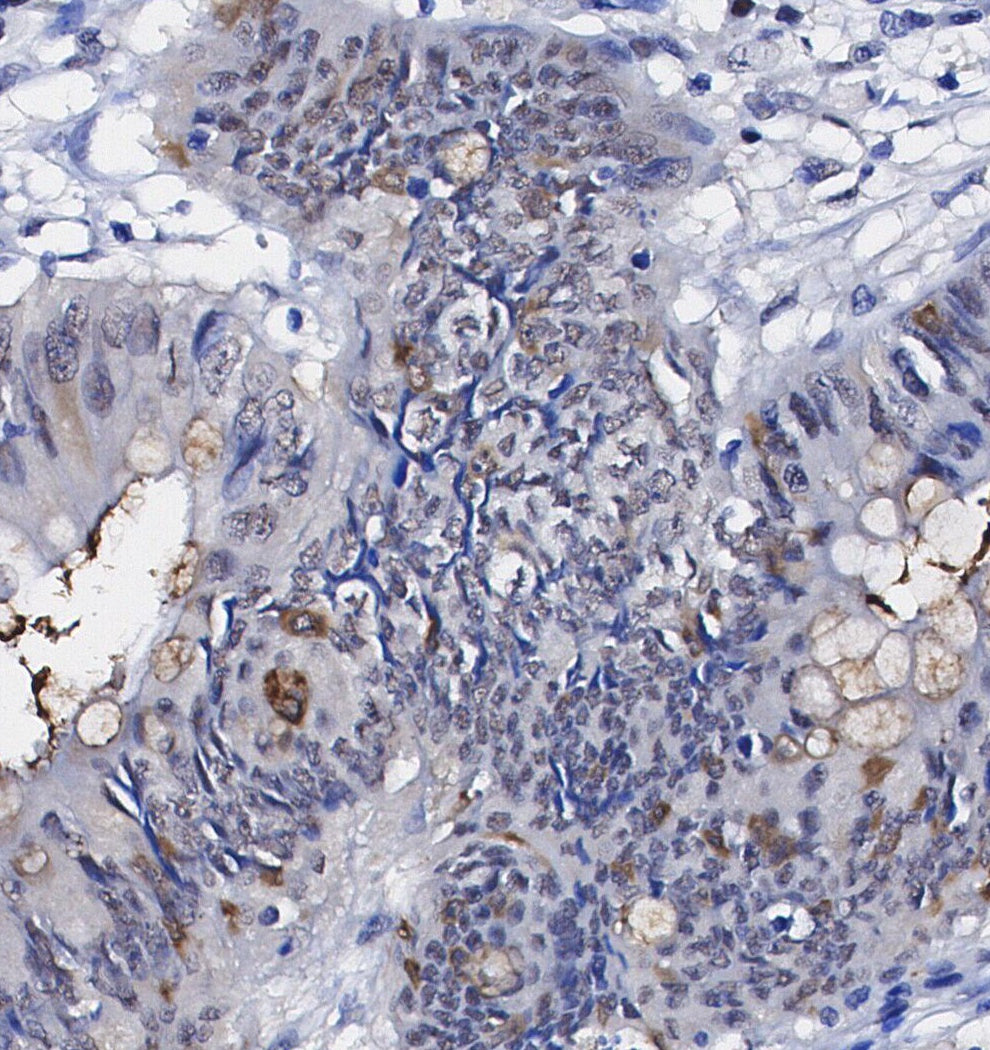 ATP6V0D1/P39 Antibody